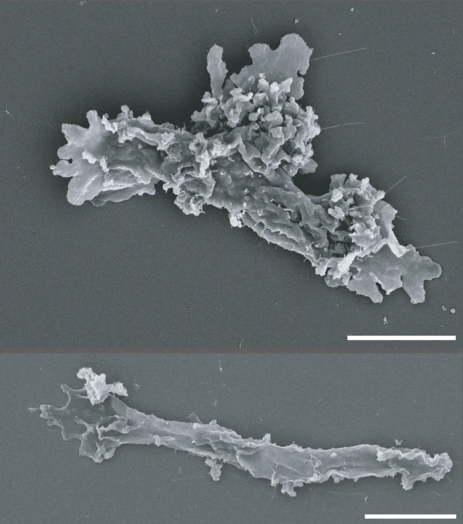 This black and white SEM image shows two examples of Incendiamoeba cascadensis. Moth are elongated cells that stretch out with pseudopodia (false feet) reaching out from the cell. The first image (top) has more pseudopodia.
